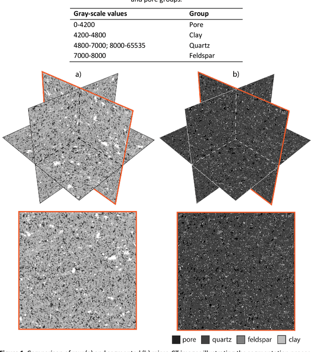 Figure 1 for Memory-Efficient Super-Resolution of 3D Micro-CT Images Using Octree-Based GANs: Enhancing Resolution and Segmentation Accuracy