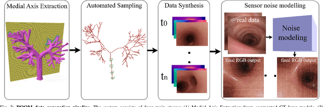 Figure 1 for ROOM: A Physics-Based Continuum Robot Simulator for Photorealistic Medical Datasets Generation