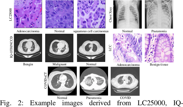 Figure 2 for Classification based deep learning models for lung cancer and disease using medical images