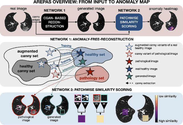 Figure 1 for AREPAS: Anomaly Detection in Fine-Grained Anatomy with Reconstruction-Based Semantic Patch-Scoring