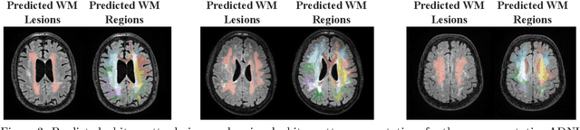 Figure 3 for Deep Learning-Based Regional White Matter Hyperintensity Mapping as a Robust Biomarker for Alzheimer's Disease
