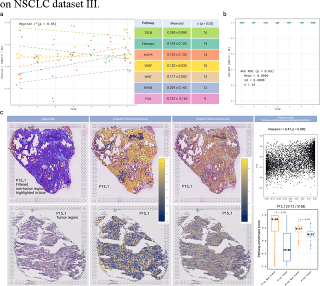 Figure 3 for Digital Modeling of Spatial Pathway Activity from Histology Reveals Tumor Microenvironment Heterogeneity