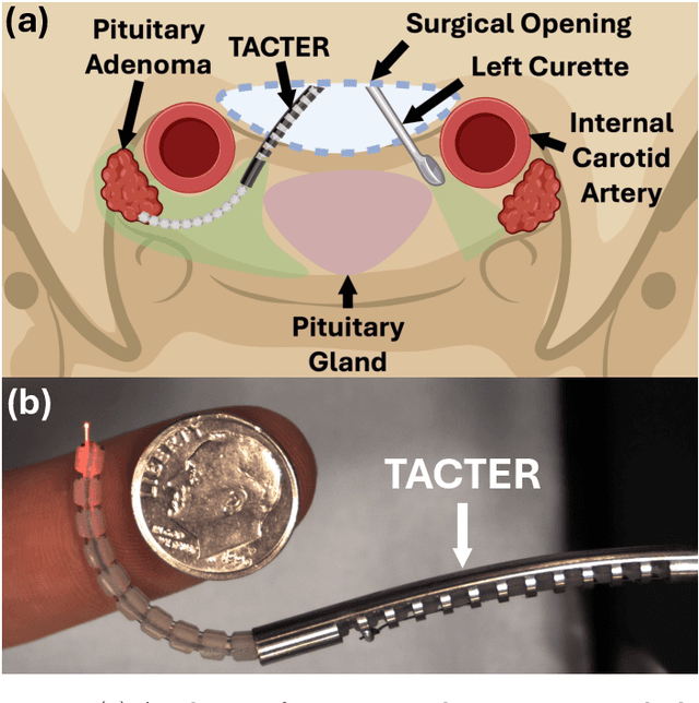 Figure 1 for Tendon-Actuated Concentric Tube Endonasal Robot (TACTER)