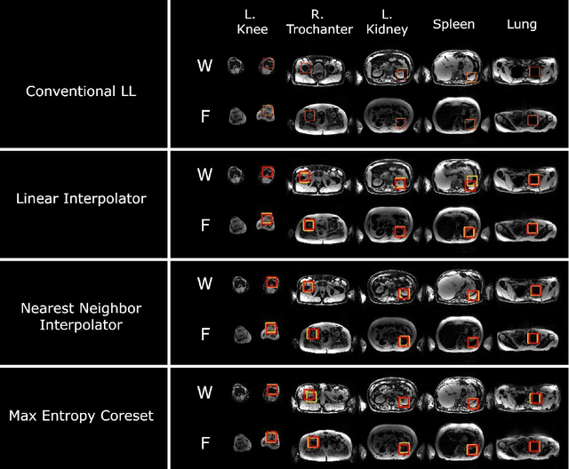 Figure 3 for A framework for dynamically training and adapting deep reinforcement learning models to different, low-compute, and continuously changing radiology deployment environments