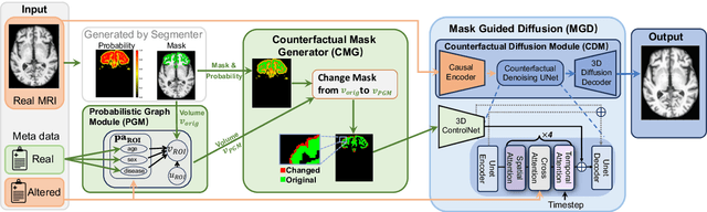 Figure 1 for Integrating Anatomical Priors into a Causal Diffusion Model