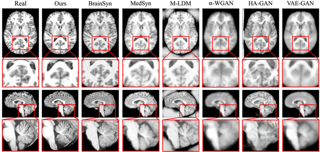 Figure 3 for Integrating Anatomical Priors into a Causal Diffusion Model