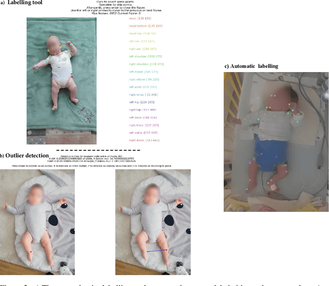 Figure 3 for Automatic Classification of General Movements in Newborns