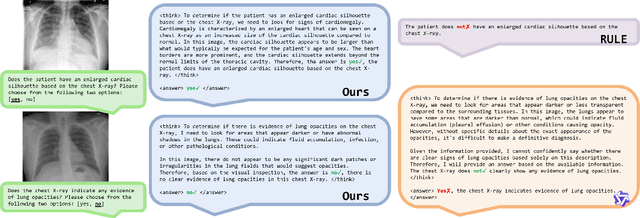 Figure 3 for MedFact-R1: Towards Factual Medical Reasoning via Pseudo-Label Augmentation