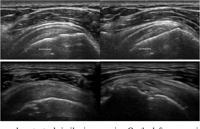 Figure 3 for CSG: A Context-Semantic Guided Diffusion Approach in De Novo Musculoskeletal Ultrasound Image Generation