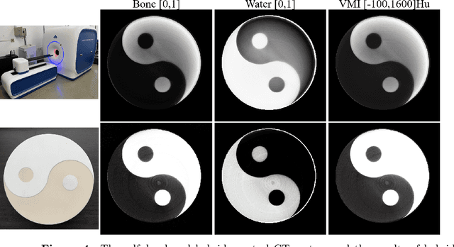 Figure 4 for First performance of hybrid spectra CT reconstruction: a general Spectrum-Model-Aided Reconstruction Technique (SMART)