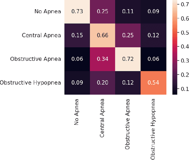 Figure 4 for Multimodal Sleep Stage and Sleep Apnea Classification Using Vision Transformer: A Multitask Explainable Learning Approach