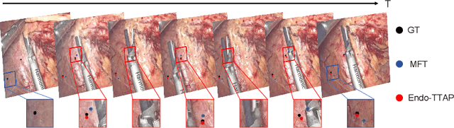 Figure 3 for Endo-TTAP: Robust Endoscopic Tissue Tracking via Multi-Facet Guided Attention and Hybrid Flow-point Supervision