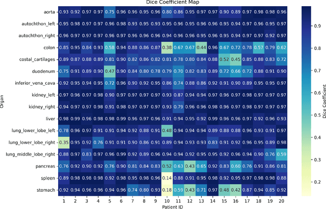 Figure 2 for seg2med: a segmentation-based medical image generation framework using denoising diffusion probabilistic models