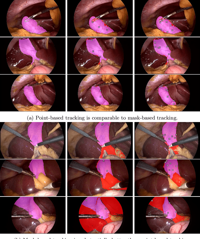 Figure 2 for When Tracking Fails: Analyzing Failure Modes of SAM2 for Point-Based Tracking in Surgical Videos
