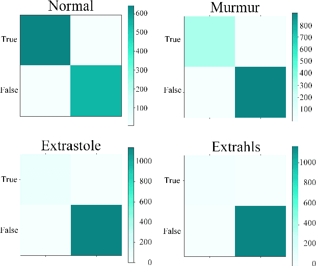 Figure 2 for ENACT-Heart -- ENsemble-based Assessment Using CNN and Transformer on Heart Sounds