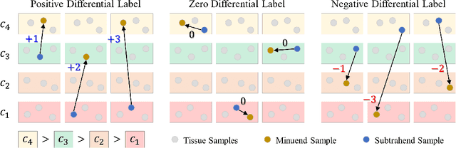 Figure 3 for DIOR-ViT: Differential Ordinal Learning Vision Transformer for Cancer Classification in Pathology Images