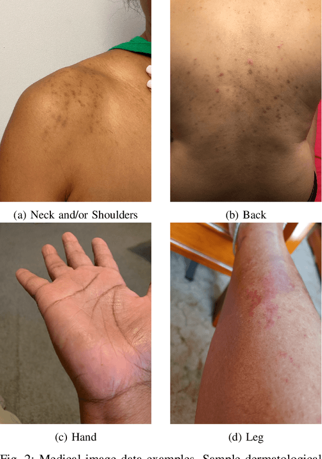 Figure 2 for Automating Weak Label Generation for Data Programming with Clinicians in the Loop