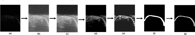 Figure 2 for Towards Non-contact 3D Ultrasound for Wrist Imaging
