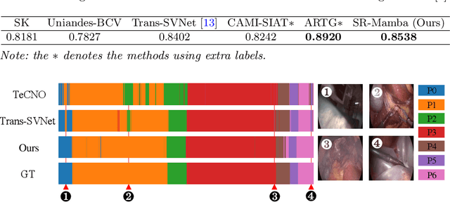 Figure 4 for SR-Mamba: Effective Surgical Phase Recognition with State Space Model