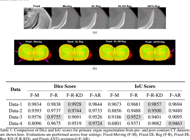 Figure 2 for Test Time Optimized Generalized AI-based Medical Image Registration Method