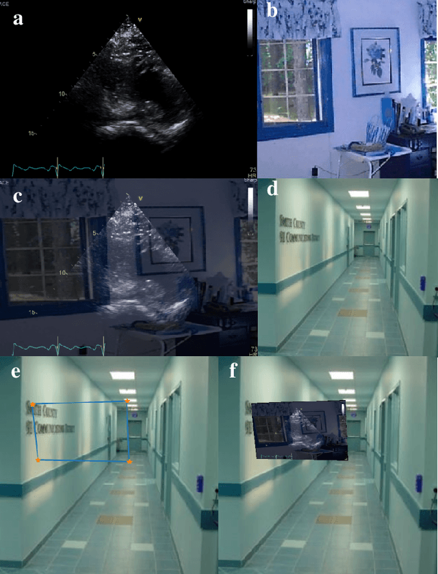 Figure 1 for Self-Supervised Ultrasound Screen Detection