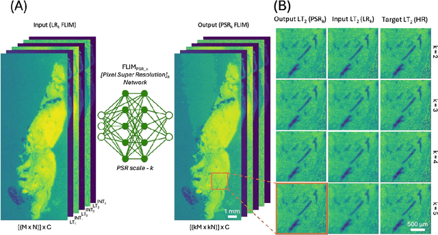 Figure 1 for Pixel Super-Resolved Fluorescence Lifetime Imaging Using Deep Learning
