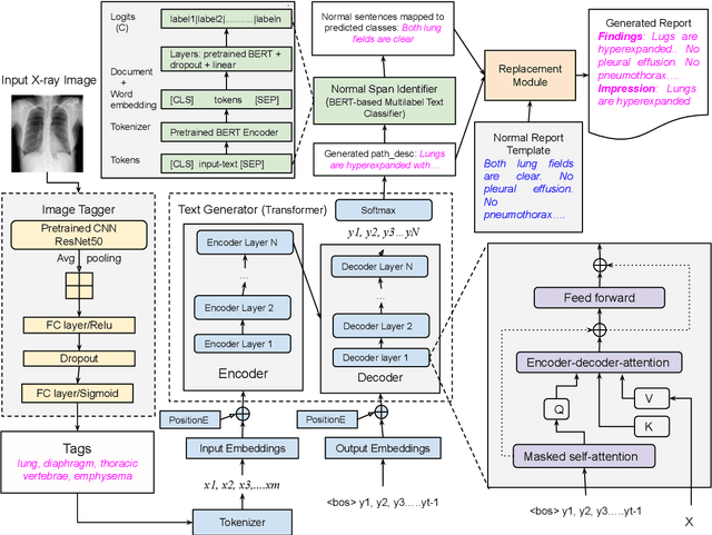 Figure 1 for Replace and Report: NLP Assisted Radiology Report Generation