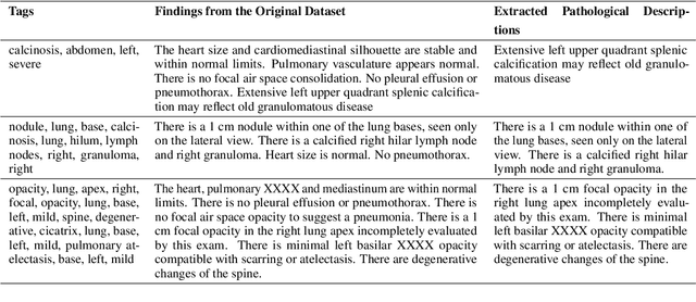 Figure 2 for Replace and Report: NLP Assisted Radiology Report Generation