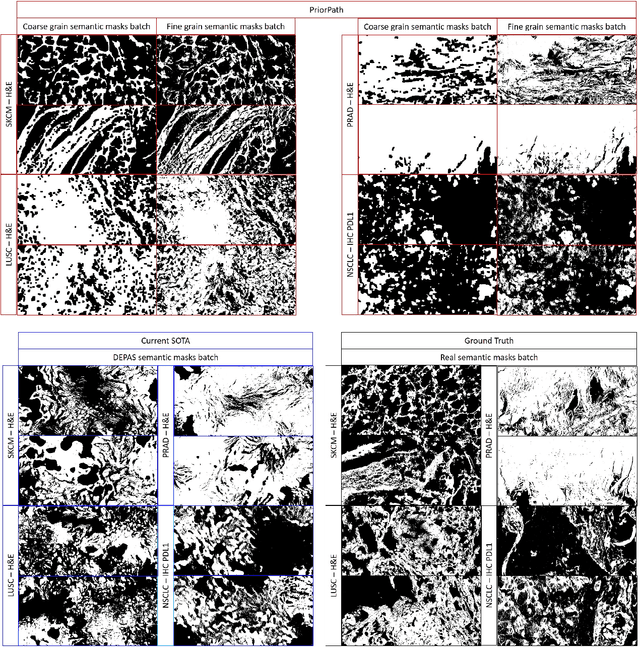Figure 3 for PriorPath: Coarse-To-Fine Approach for Controlled De-Novo Pathology Semantic Masks Generation