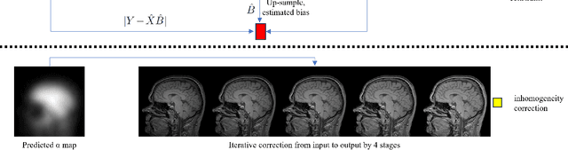 Figure 1 for Zero-shot Bias Correction: Efficient MR Image Inhomogeneity Reduction Without Any Data