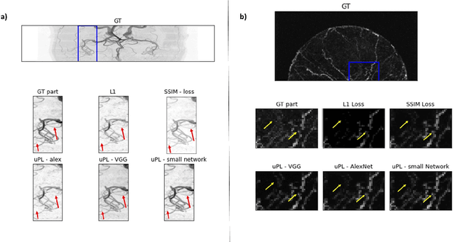 Figure 3 for Untrained Perceptual Loss for image denoising of line-like structures in MR images