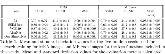 Figure 2 for Untrained Perceptual Loss for image denoising of line-like structures in MR images
