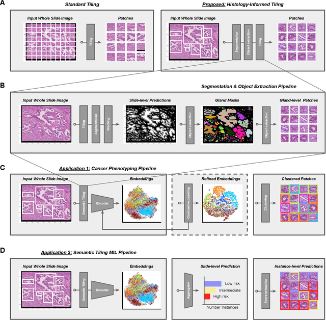 Figure 1 for Histology-informed tiling of whole tissue sections improves the interpretability and predictability of cancer relapse and genetic alterations