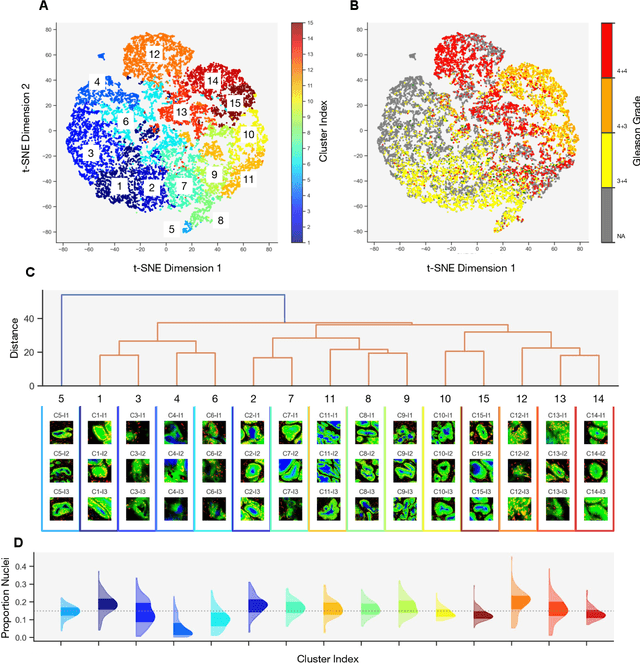 Figure 3 for Histology-informed tiling of whole tissue sections improves the interpretability and predictability of cancer relapse and genetic alterations