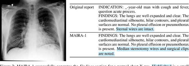 Figure 3 for MAIRA-1: A specialised large multimodal model for radiology report generation