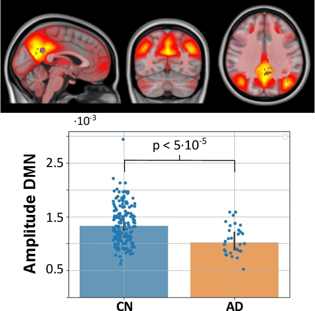 Figure 3 for JUMP: A joint multimodal registration pipeline for neuroimaging with minimal preprocessing