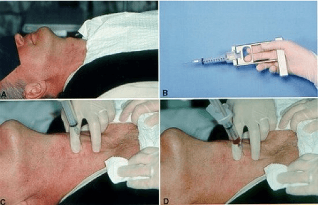 Figure 4 for From Data to Insights: A Comprehensive Survey on Advanced Applications in Thyroid Cancer Research
