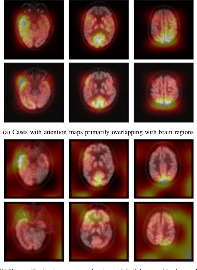 Figure 3 for Clinically-Inspired Multi-Agent Transformers for Disease Trajectory Forecasting from Multimodal Data
