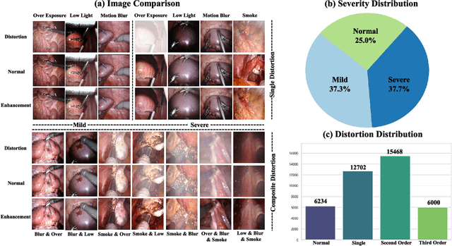 Figure 3 for SurgVisAgent: Multimodal Agentic Model for Versatile Surgical Visual Enhancement
