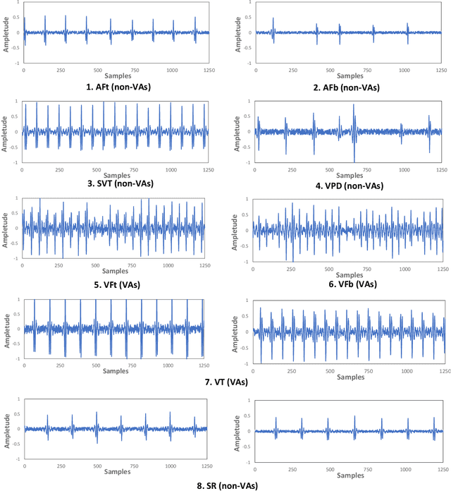 Figure 1 for TinyML Design Contest for Life-Threatening Ventricular Arrhythmia Detection
