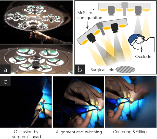 Figure 1 for Disturbance-Free Surgical Video Generation from Multi-Camera Shadowless Lamps for Open Surgery