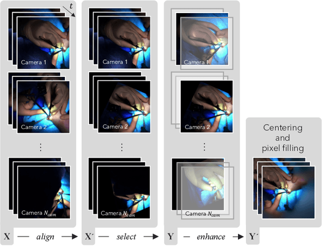 Figure 2 for Disturbance-Free Surgical Video Generation from Multi-Camera Shadowless Lamps for Open Surgery