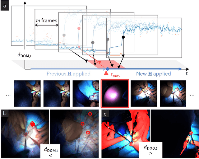 Figure 3 for Disturbance-Free Surgical Video Generation from Multi-Camera Shadowless Lamps for Open Surgery