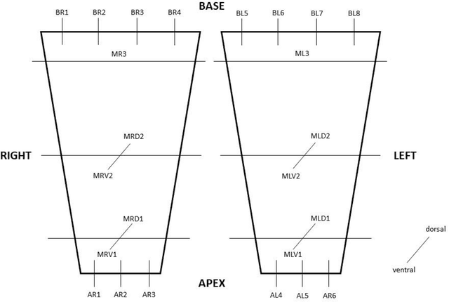 Figure 2 for Volumetric Reconstruction of Prostatectomy Specimens from Histology