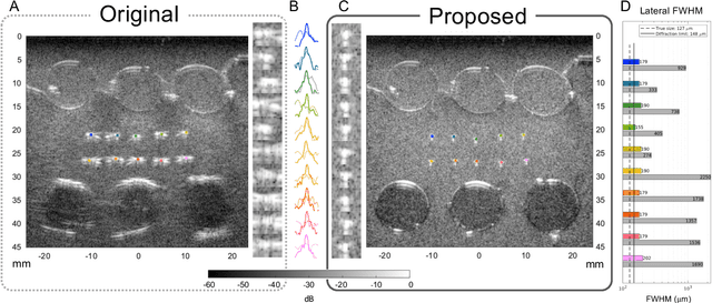 Figure 2 for Ultrasound Autofocusing: Common Midpoint Phase Error Optimization via Differentiable Beamforming