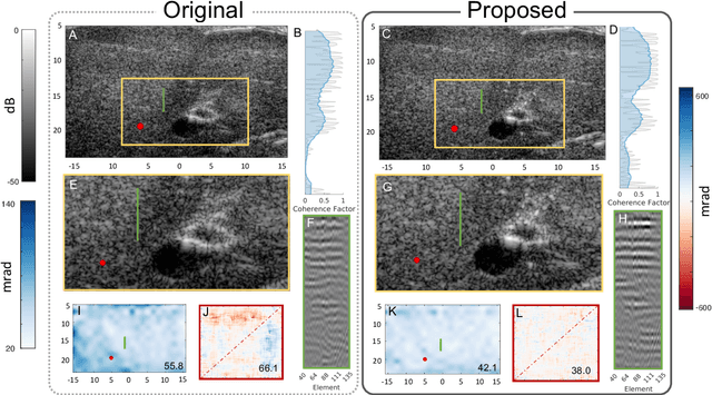 Figure 3 for Ultrasound Autofocusing: Common Midpoint Phase Error Optimization via Differentiable Beamforming