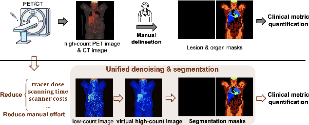 Figure 1 for Anatomically and Metabolically Informed Diffusion for Unified Denoising and Segmentation in Low-Count PET Imaging