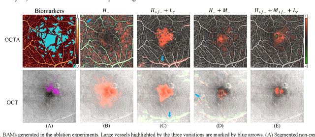 Figure 2 for Interpretable Diabetic Retinopathy Diagnosis based on Biomarker Activation Map