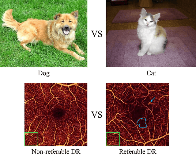 Figure 1 for Interpretable Diabetic Retinopathy Diagnosis based on Biomarker Activation Map