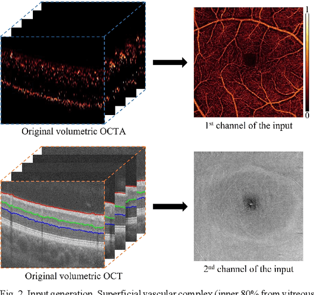 Figure 3 for Interpretable Diabetic Retinopathy Diagnosis based on Biomarker Activation Map